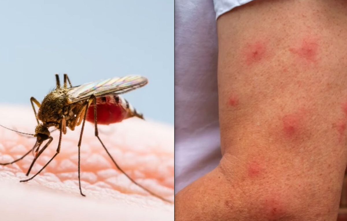 komar i ślad po ukąszeniu przez owada