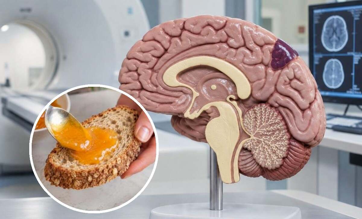 żółtko zmniejsza ryzyko choroby alzheimra